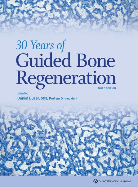 Produktbild: 30 Years of Guided Bone Regeneration