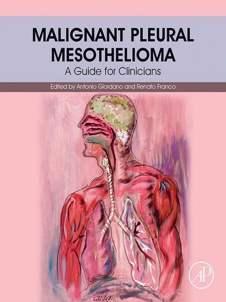 Produktbild: Malignant Pleural Mesothelioma