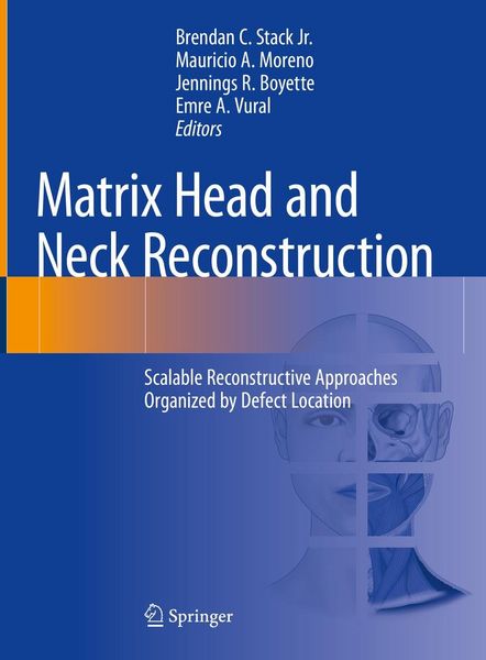 Produktbild: Matrix Head and Neck Reconstruction