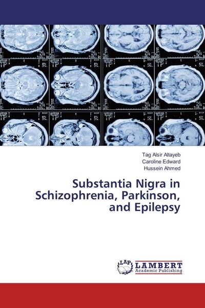 Produktbild: Substantia Nigra in Schizophrenia, Parkinson, and Epilepsy