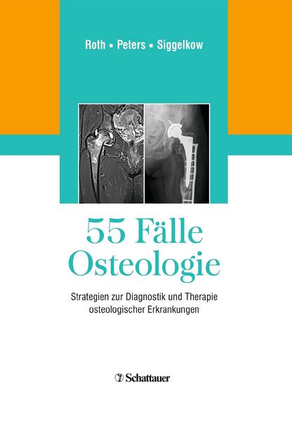 Produktbild: 55 F&auml;lle Osteologie