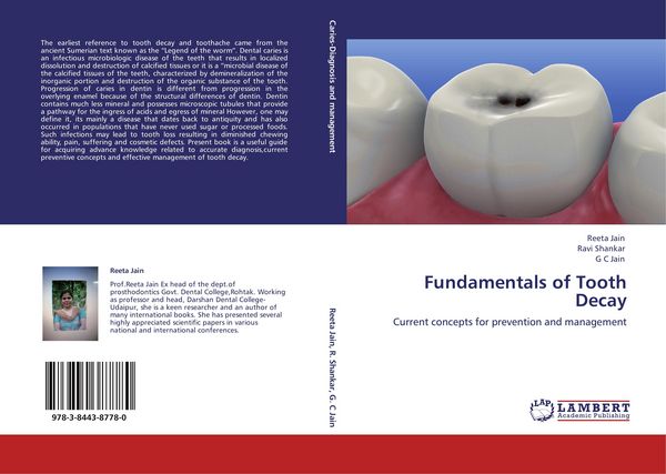 Produktbild: Fundamentals of Tooth Decay