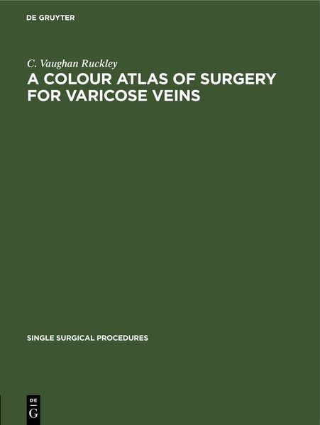 Produktbild: A Colour Atlas of Surgery for Varicose Veins