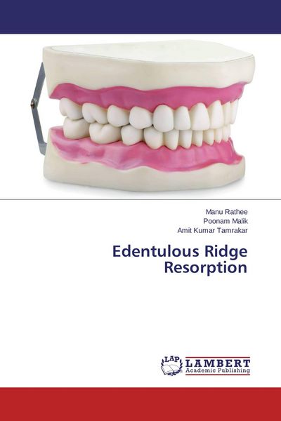 Produktbild: Edentulous Ridge Resorption