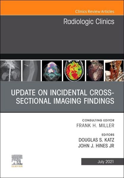 Produktbild: Update on Incidental Cross-Sectional Imaging Findings, an Issue of Radiologic Clinics of North America