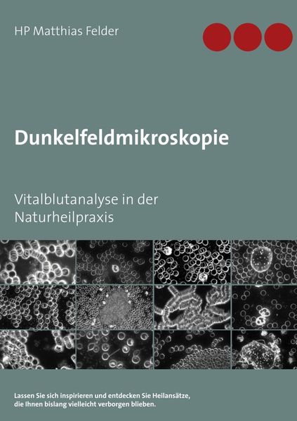 Produktbild: Dunkelfeldmikroskopie