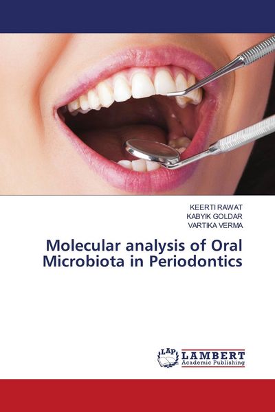 Produktbild: Molecular analysis of Oral Microbiota in Periodontics