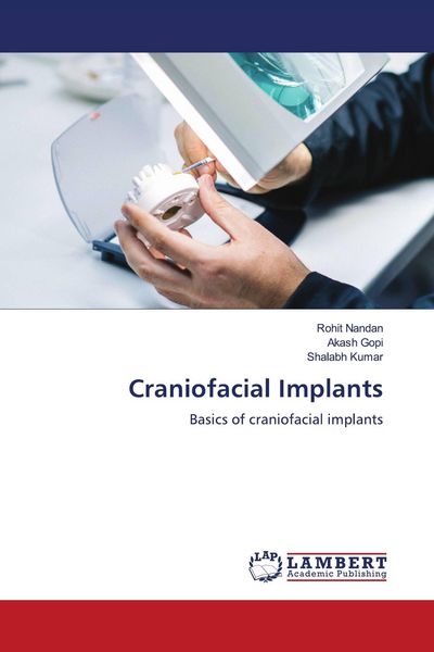 Produktbild: Craniofacial Implants