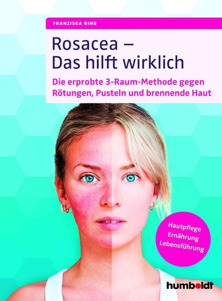 Produktbild: Rosacea - Das hilft wirklich