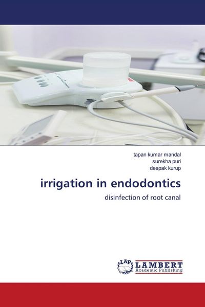 Produktbild: Irrigation in endodontics