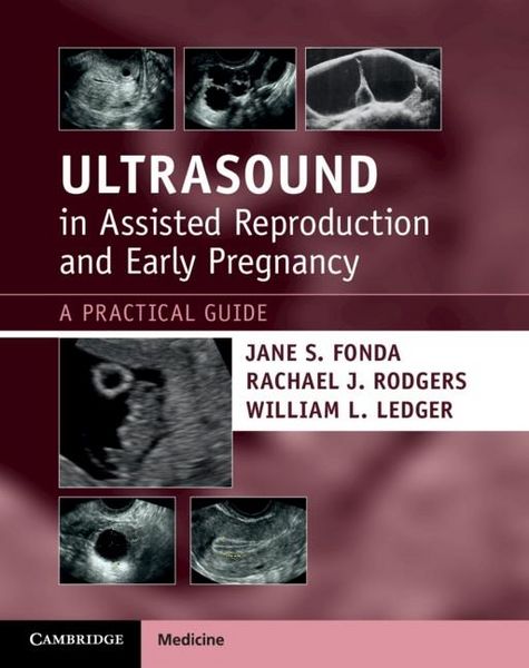 Produktbild: Ultrasound in Assisted Reproduction and Early Pregnancy