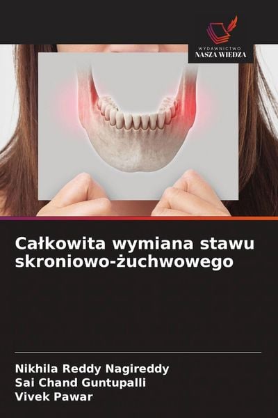 Produktbild: Ca&iquest;kowita wymiana stawu skroniowo-&iquest;uchwowego