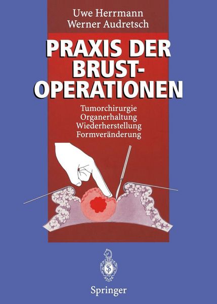 Produktbild: Praxis der Brustoperationen