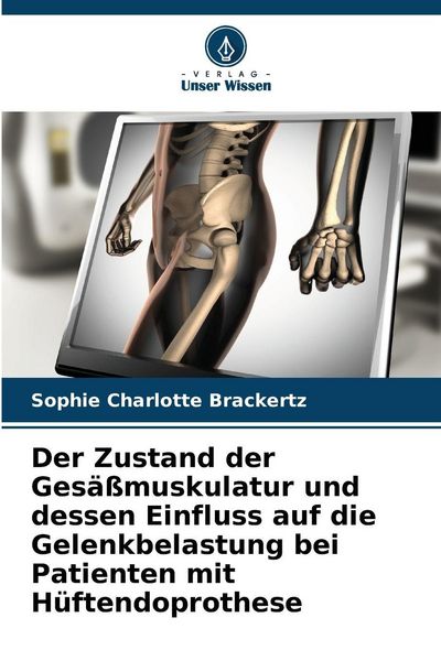 Produktbild: Der Zustand der Ges&auml;&szlig;muskulatur und dessen Einfluss auf die Gelenkbelastung bei Patienten mit H&uuml;ftendoprothese