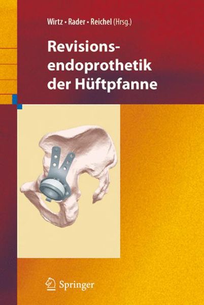 Produktbild: Revisionsendoprothetik der H&uuml;ftpfanne