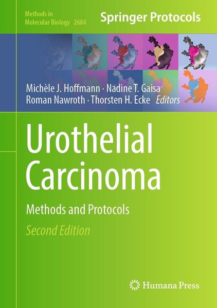 Produktbild: Urothelial Carcinoma