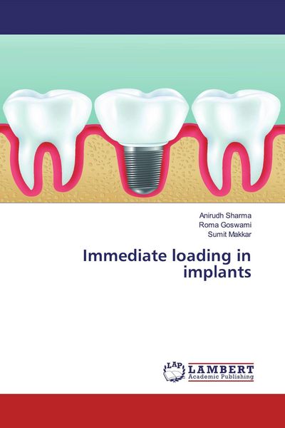 Produktbild: Immediate loading in implants