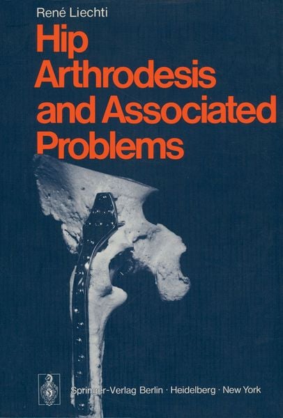 Produktbild: Hip Arthrodesis and Associated Problems