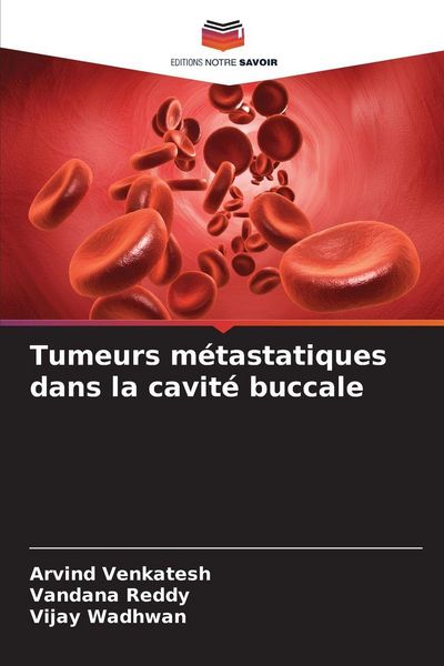 Produktbild: Tumeurs m&eacute;tastatiques dans la cavit&eacute; buccale
