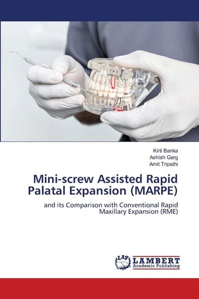 Produktbild: Mini-screw Assisted Rapid Palatal Expansion (MARPE)