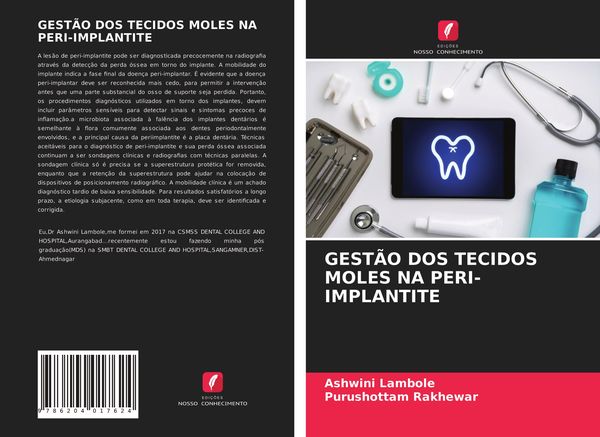 Produktbild: Gest&atilde;o Dos Tecidos Moles Na Peri-Implantite