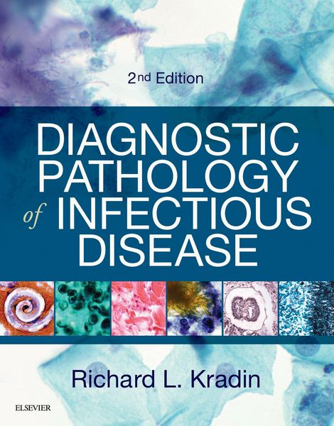 Produktbild: Diagnostic Pathology of Infectious Disease E-Book