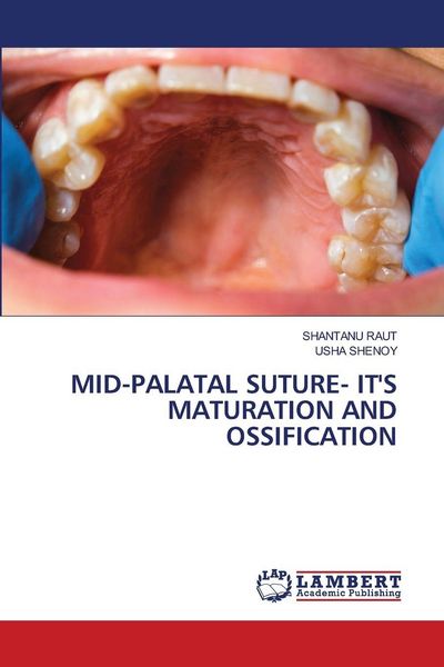 Produktbild: Mid-Palatal Suture- It's Maturation and Ossification