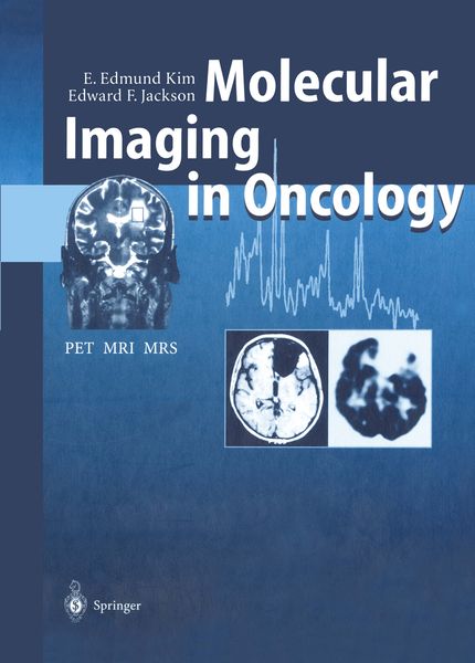 Produktbild: Molecular Imaging in Oncology
