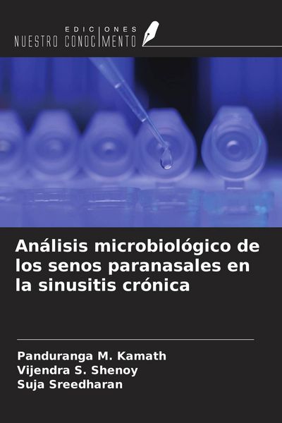 Produktbild: An&aacute;lisis microbiol&oacute;gico de los senos paranasales en la sinusitis cr&oacute;nica