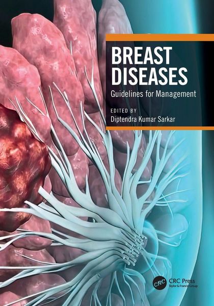 Produktbild: Breast Diseases