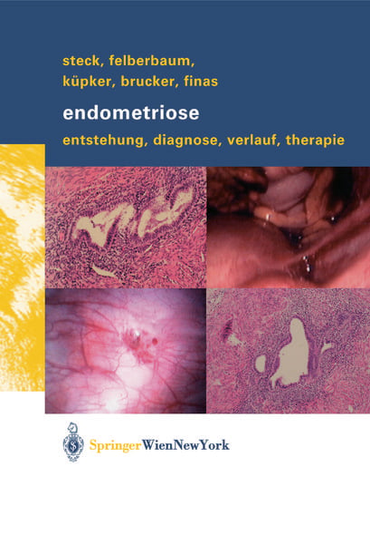 Produktbild: Endometriose