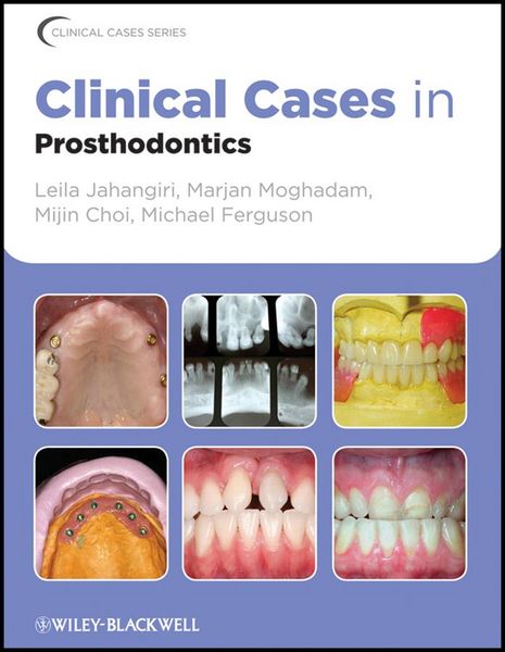 Produktbild: Clinical Cases in Prosthodontics