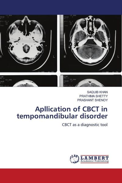 Produktbild: Apllication of CBCT in tempomandibular disorder