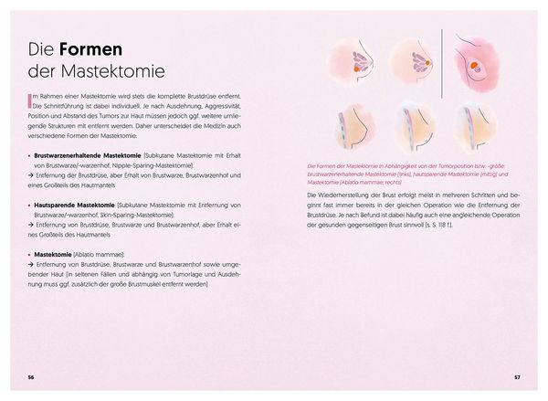 Produktbild: Diagnose Brustkrebs