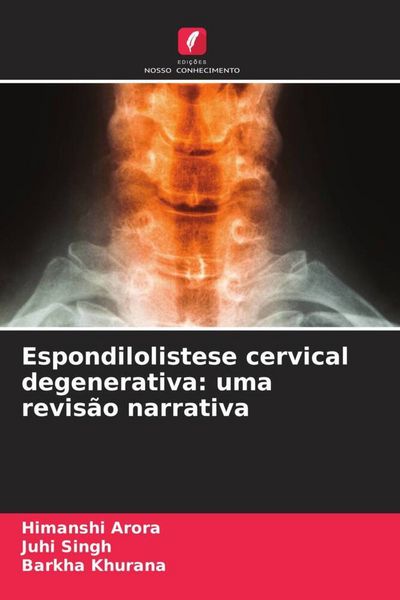 Produktbild: Espondilolistese cervical degenerativa: uma revis&atilde;o narrativa