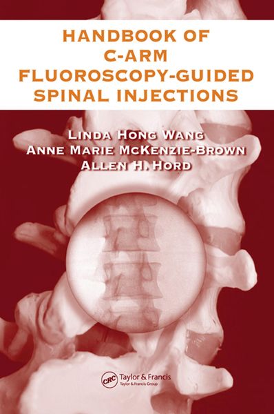 Produktbild: The Handbook of C-Arm Fluoroscopy-Guided Spinal Injections