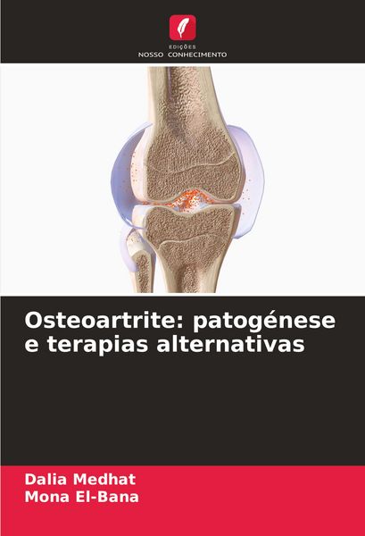 Produktbild: Osteoartrite: patog&eacute;nese e terapias alternativas