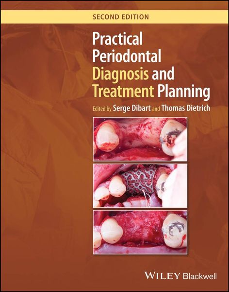 Produktbild: Practical Periodontal Diagnosis and Treatment Planning