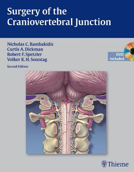 Produktbild: Surgery of the Craniovertebral Junction