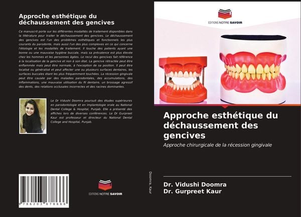 Produktbild: Approche esth&eacute;tique du d&eacute;chaussement des gencives