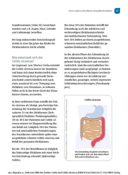 Produktbild: Wirksame Hilfe bei Morbus Crohn und Colitis ulcerosa
