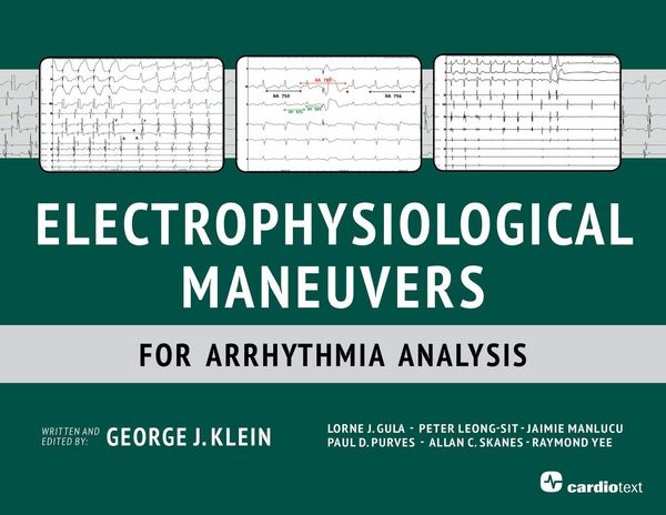 Produktbild: Electrophysiological Maneuvers for Arrhythmia Analysis