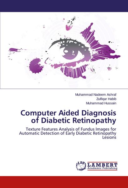 Produktbild: Computer Aided Diagnosis of Diabetic Retinopathy