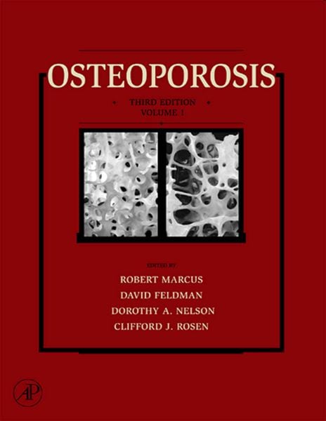 Produktbild: Osteoporosis