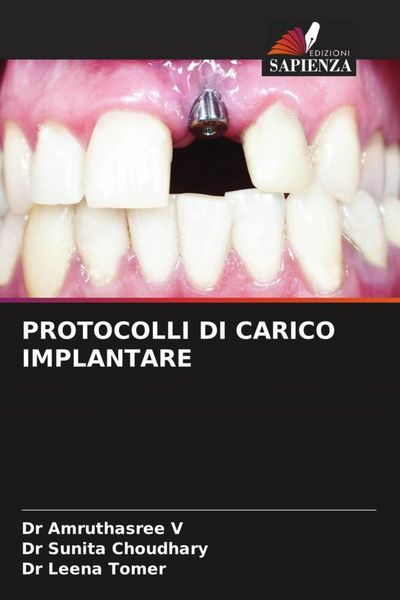 Produktbild: Protocolli Di Carico Implantare
