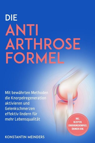 Produktbild: Die Anti Arthrose Formel: Mit bew&auml;hrten Methoden die Knorpelregeneration aktivieren und Gelenkschmerzen effektiv lindern f&uuml;r mehr Lebensqualit&auml;t - ink