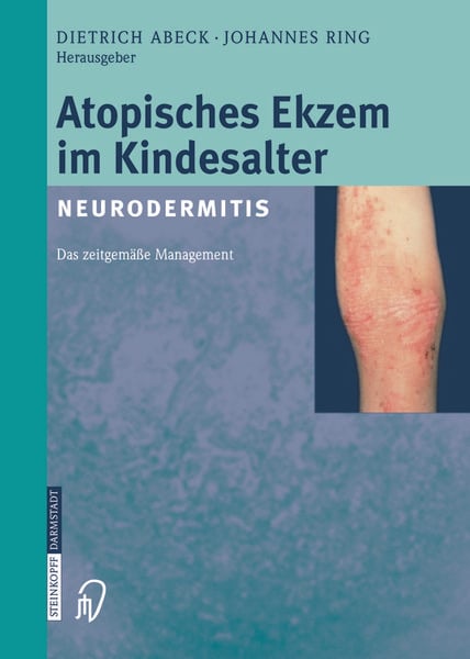 Produktbild: Atopisches Ekzem im Kindesalter (Neurodermitis)
