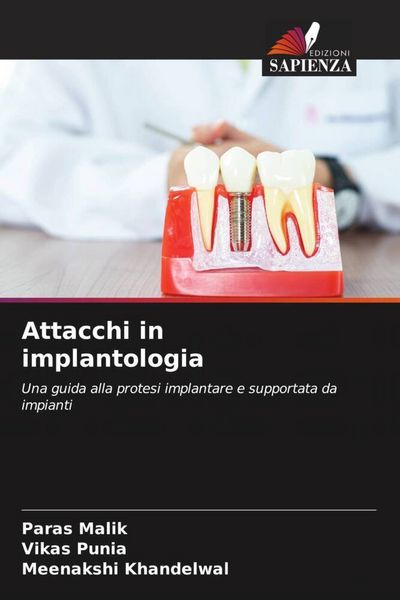 Produktbild: Attacchi in implantologia