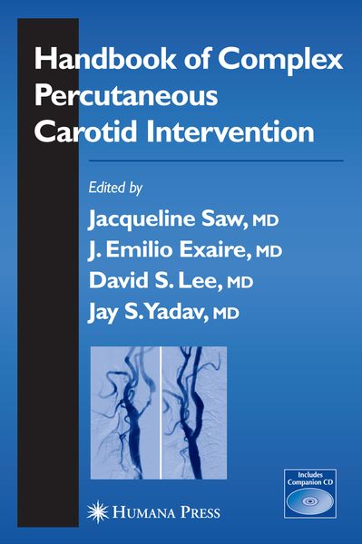 Produktbild: Handbook of Complex Percutaneous Carotid Intervention