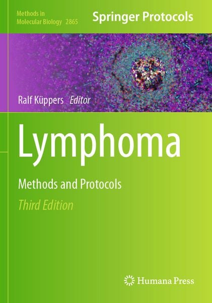Produktbild: Lymphoma